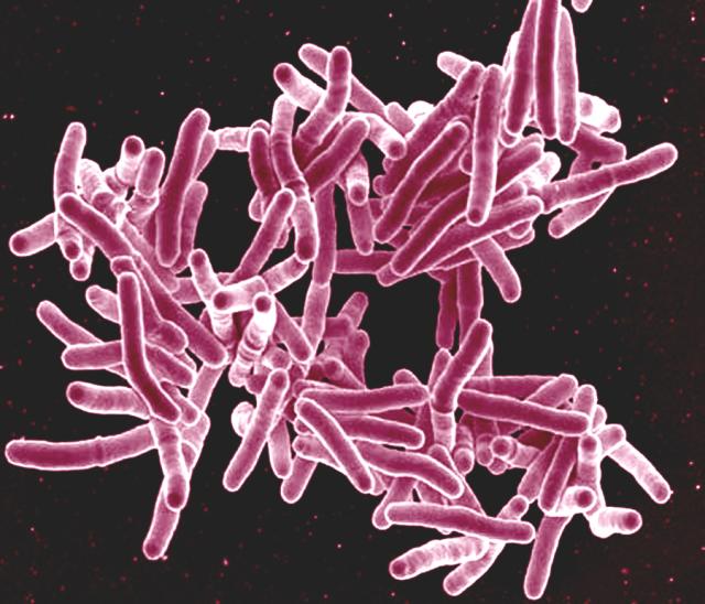 Scientists are developing compounds that re-sensitise the TB bacterium to antibiotics by breaking down its defensive biofilm. Mycobacterium tuberculosis. Image credit - Flickr/NIAID, licensed under CC BY 2.0